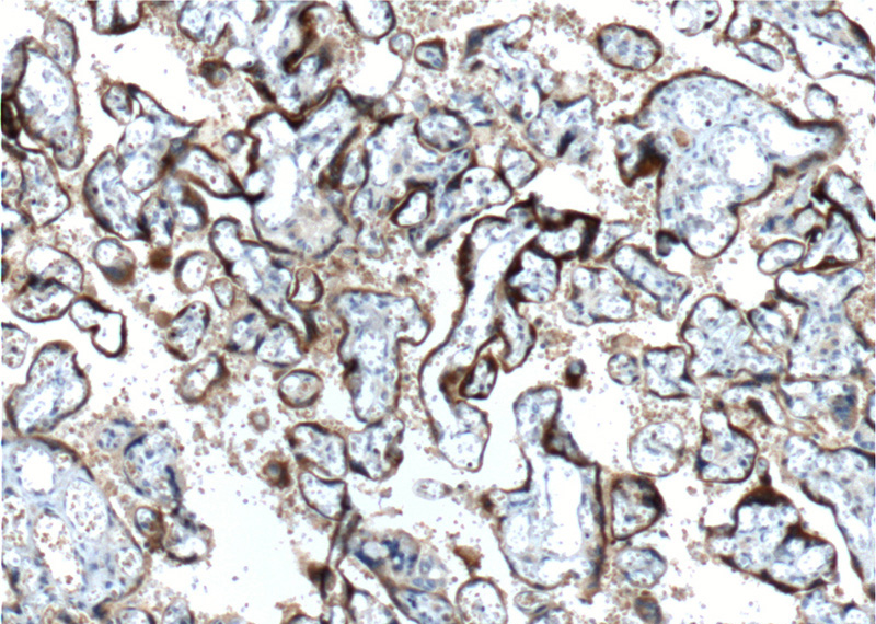 Immunohistochemistry of paraffin-embedded human placenta tissue slide using Catalog No:107151(CGB,hCG Antibody) at dilution of 1:1000 (under 10x lens). heat mediated antigen retrieved with Tris-EDTA buffer(pH9).