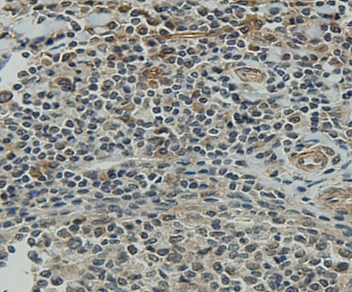 Fig2: Immunohistochemical analysis of paraffin-embedded human tonsil tissue using anti-CCDC51 antibody. Counter stained with hematoxylin