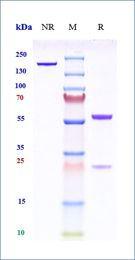 SDAS-PAGE of Anti-N protein Human mAb