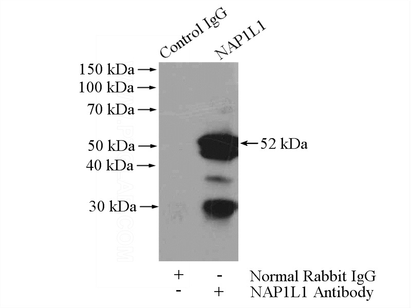 IP Result of anti-NAP1L1 (IP:Catalog No:112945, 4ug; Detection:Catalog No:112945 1:1000) with HEK-293 cells lysate 800ug.