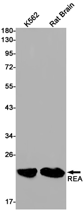 Western blot detection of RAC3 in K562,Rat Brain cell lysates using RAC3 Rabbit pAb(1:1000 diluted).Predicted band size:21kDa.Observed band size:21kDa.