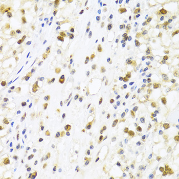 Immunohistochemistry - SUMO4 Polyclonal Antibody 