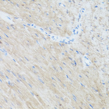 Immunohistochemistry - CLUH Polyclonal Antibody 