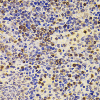 Immunohistochemistry - PRDM5 Polyclonal Antibody 