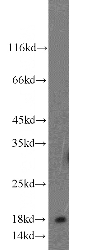 mouse lung tissue were subjected to SDS PAGE followed by western blot with Catalog No:107666(A2LD1 antibody) at dilution of 1:500