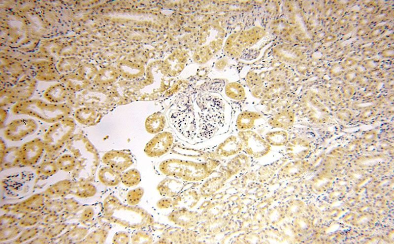 Immunohistochemical of paraffin-embedded human kidney using Catalog No:111303(HEXB antibody) at dilution of 1:50 (under 10x lens)
