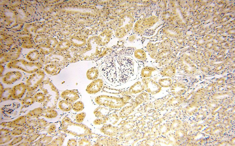 Immunohistochemical of paraffin-embedded human kidney using Catalog No:111303(HEXB antibody) at dilution of 1:50 (under 10x lens)