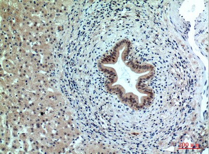 Fig2:; Immunohistochemical analysis of paraffin-embedded human-liver, antibody was diluted at 1:100