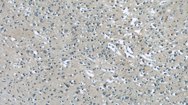 Immunohistochemistry of paraffin-embedded human brain tissue slide using Catalog No:115055(SAMD9L Antibody) at dilution of 1:50 (under 10x lens)