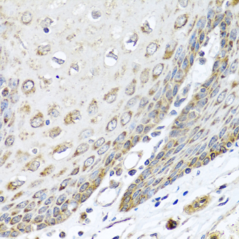 Immunohistochemistry - DEDD Polyclonal Antibody 