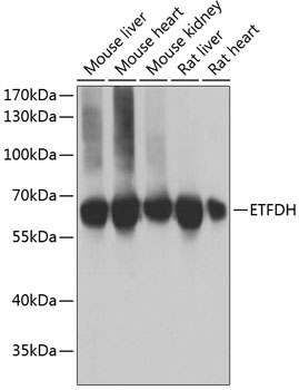 Western blot - ETFDH Polyclonal Antibody 