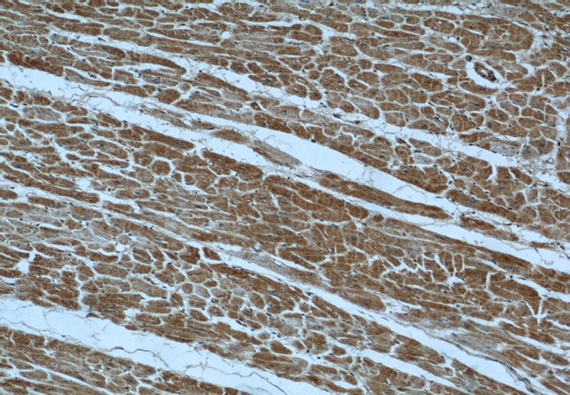 Immunohistochemical of paraffin-embedded human heart using Catalog No:109431(CNOT1 antibody) at dilution of 1:50 (under 10x lens)