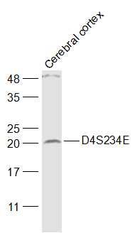 Fig3: Sample:; Cerebral cortex (Mouse) Lysate at 40 ug; Primary: Anti-D4S234E at 1/1000 dilution; Secondary: IRDye800CW Goat Anti-Rabbit IgG at 1/20000 dilution; Predicted band size: 21 kD; Observed band size: 21 kD