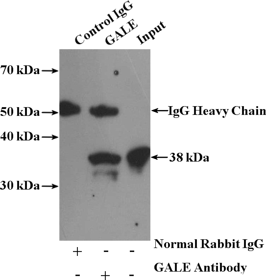 IP Result of anti-GALE (IP:Catalog No:110835, 4ug; Detection:Catalog No:110835 1:300) with HeLa cells lysate 1080ug.