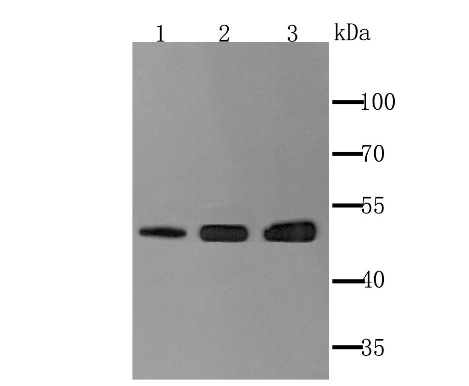 Fig1:; Western blot analysis of Ephrin B2 on different lysates. Proteins were transferred to a PVDF membrane and blocked with 5% BSA in PBS for 1 hour at room temperature. The primary antibody ( 1/500) was used in 5% BSA at room temperature for 2 hours. Goat Anti-Rabbit IgG - HRP Secondary Antibody (HA1001) at 1:200,000 dilution was used for 1 hour at room temperature.; Positive control:; Lane 1: Human kidney tissue lysate; Lane 2: Mouse lung tissue lysate; Lane 3: Rat brain tissue lysate