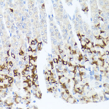 Immunohistochemistry - GPM6A Polyclonal Antibody 