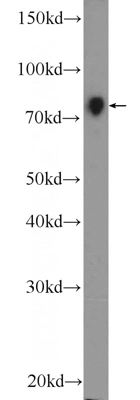 HeLa cells were subjected to SDS PAGE followed by western blot with Catalog No:113230(NR1D2 Antibody) at dilution of 1:300