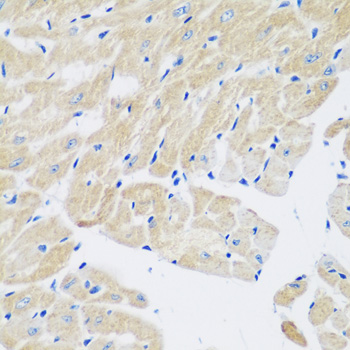 Immunohistochemistry - TGM5 Polyclonal Antibody 
