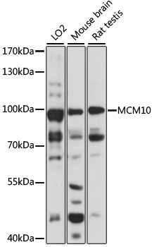 Western blot - MCM10 Polyclonal Antibody 