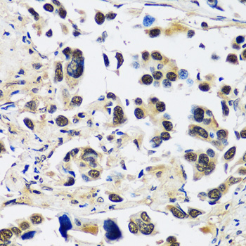 Immunohistochemistry - CCDC59 Polyclonal Antibody 