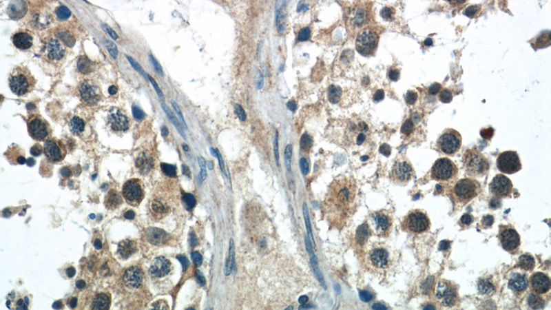 Immunohistochemistry of paraffin-embedded human testis tissue slide using Catalog No:113142(NFATC2 Antibody) at dilution of 1:50 (under 40x lens)