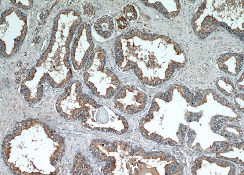 Immunohistochemical of paraffin-embedded human prostate hyperplasia using Catalog No:112197(LEPR antibody) at dilution of 1:50 (under 10x lens)