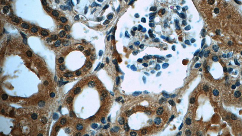 Immunohistochemistry of paraffin-embedded human kidney tissue slide using Catalog No:107642(TRAPPC9,NIBP Antibody) at dilution of 1:50 under 40x lens