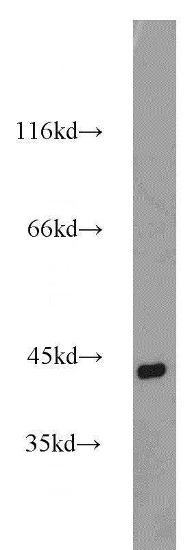 mouse heart tissue were subjected to SDS PAGE followed by western blot with Catalog No:107706(ACTA2 antibody) at dilution of 1:1000