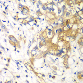 Immunohistochemistry - KLK10 Polyclonal Antibody 
