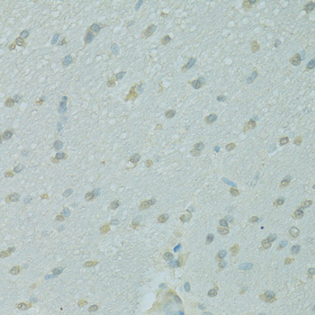 Immunohistochemistry - NCOA2 Polyclonal Antibody 