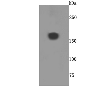 Fig1: Western blot analysis of A2M on human placenta cells lysates using anti-A2M antibody at 1/500 dilution.