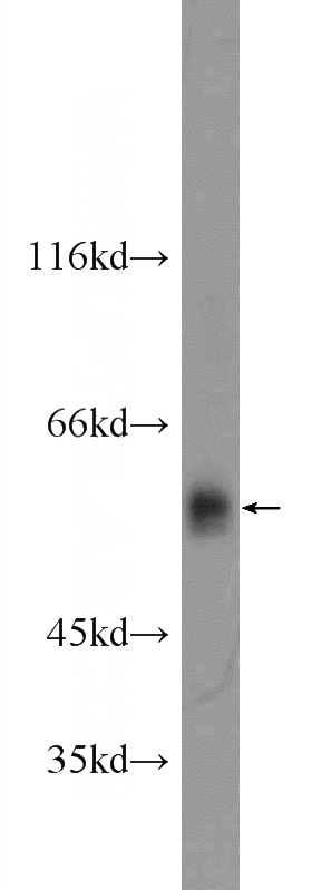 mouse liver tissue were subjected to SDS PAGE followed by western blot with Catalog No:108150(ARMC5 Antibody) at dilution of 1:300