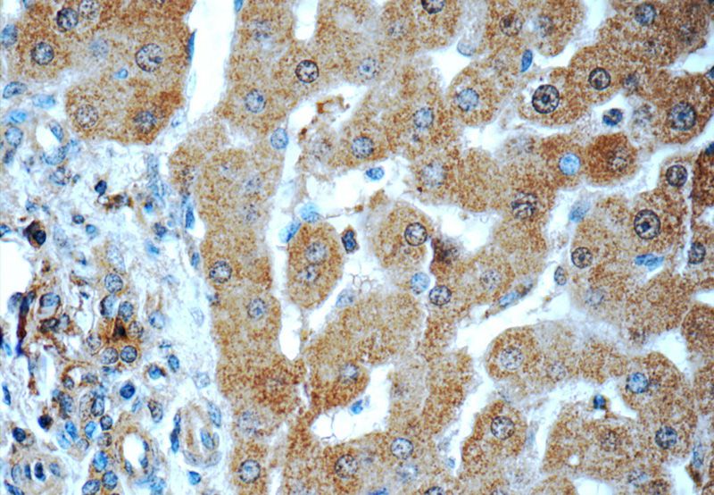 Immunohistochemistry of paraffin-embedded human liver tissue slide using Catalog No:115705(STEAP3 Antibody) at dilution of 1:50 (under 40x lens)