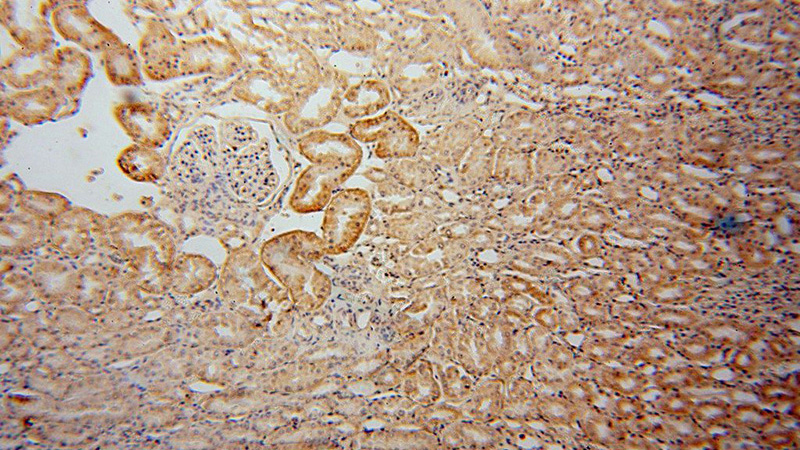 Immunohistochemical of paraffin-embedded human kidney using Catalog No:112008(KIF26B antibody) at dilution of 1:50 (under 10x lens)