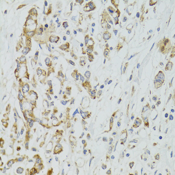 Immunohistochemistry - DICER1 Polyclonal Antibody 