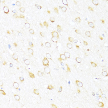 Immunohistochemistry - DDX3Y Polyclonal Antibody 
