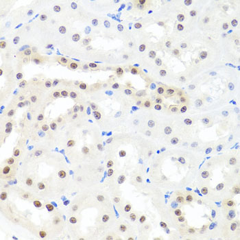 Immunohistochemistry - HNRNPCL1 Polyclonal Antibody 