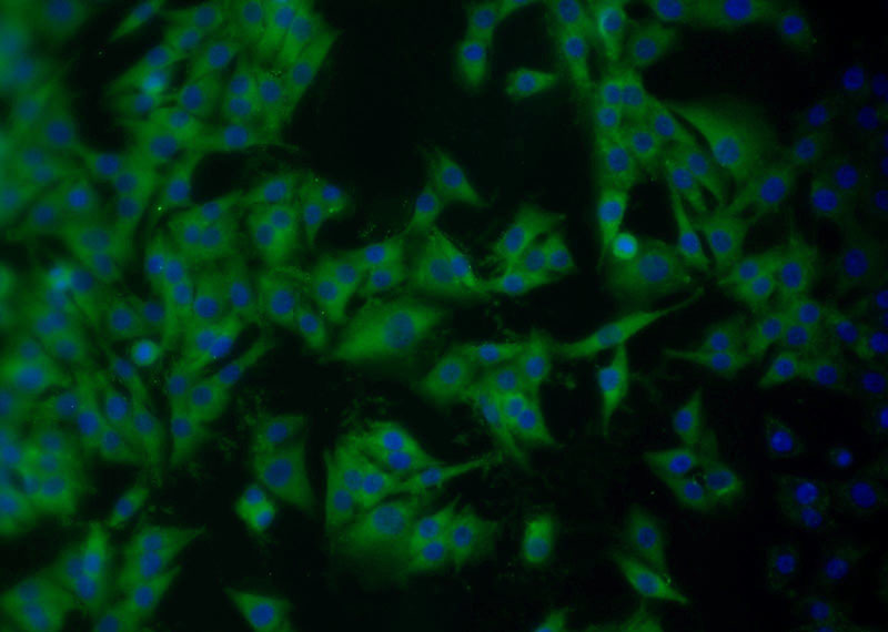 Immunofluorescent analysis of A375 cells using Catalog No:108170(ARPP-19 Antibody) at dilution of 1:25 and Alexa Fluor 488-congugated AffiniPure Goat Anti-Rabbit IgG(H+L)
