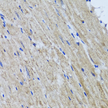 Immunohistochemistry - HYAL1 Polyclonal Antibody 