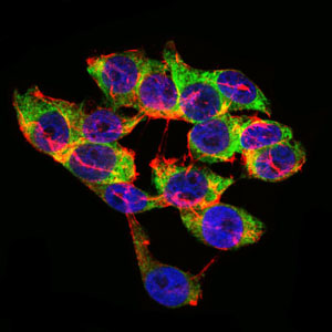 Fig2: ICC staining Lipoprotein a (green) and actin filaments (red) in HepG2 cell. The nuclear counter stain is DAPI (blue). Cells were fixed in paraformaldehyde, permeabilised with 0.25% Triton X100/PBS.