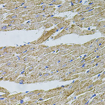 Immunohistochemistry - TRPA1 Polyclonal Antibody 