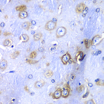 Immunohistochemistry - RPS3A Polyclonal Antibody 