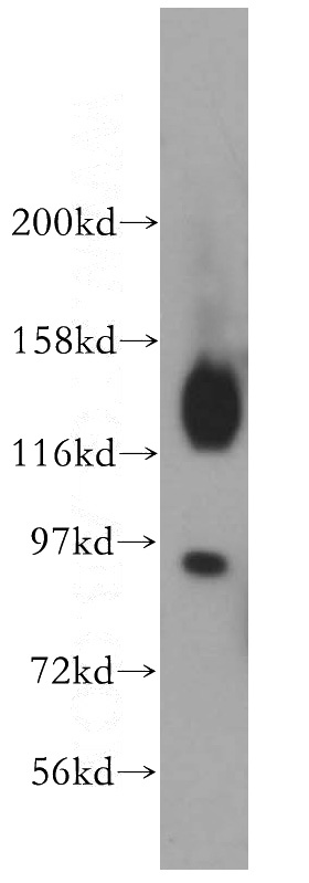 human brain tissue were subjected to SDS PAGE followed by western blot with Catalog No:116742(VEZT antibody) at dilution of 1:500