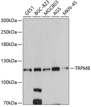 Western blot - TRPM8 Polyclonal Antibody 