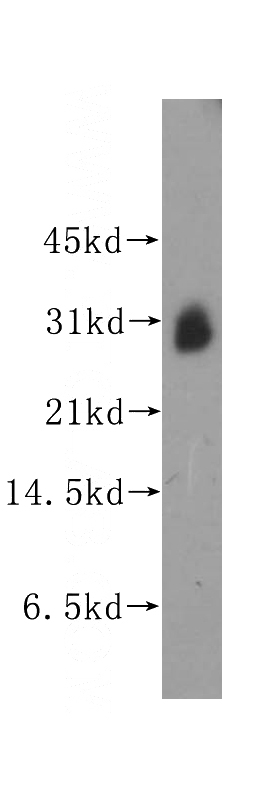 human brain tissue were subjected to SDS PAGE followed by western blot with Catalog No:111966(KCNIP3 antibody) at dilution of 1:500