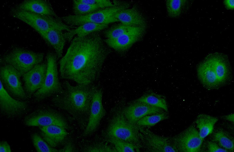 Immunofluorescent analysis of A549 cells using Catalog No:112385(MAGEB18 Antibody) at dilution of 1:50 and Alexa Fluor 488-congugated AffiniPure Goat Anti-Rabbit IgG(H+L)