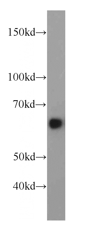 mouse brain tissue were subjected to SDS PAGE followed by western blot with Catalog No:111291(HEPACAM antibody) at dilution of 1:500