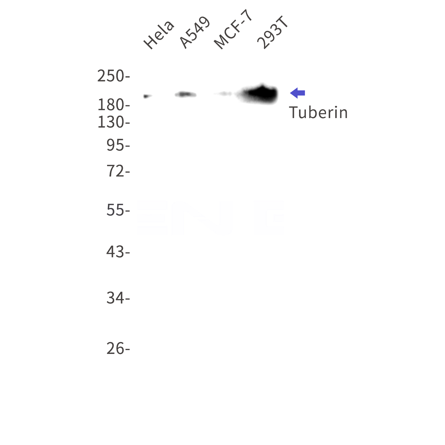 Western blot detection of Tuberin in Hela,A549,MCF-7,293T cell lysates using Tuberin Rabbit mAb(1:1000 diluted).Predicted band size:201kDa.Observed band size:201kDa.