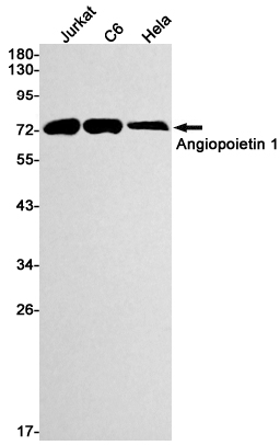 Western blot detection of Angiopoietin 1 in Jurkat,C6,Hela cell lysates using Angiopoietin 1 Rabbit mAb(1:1000 diluted).Predicted band size:58kDa.Observed band size:75kDa.