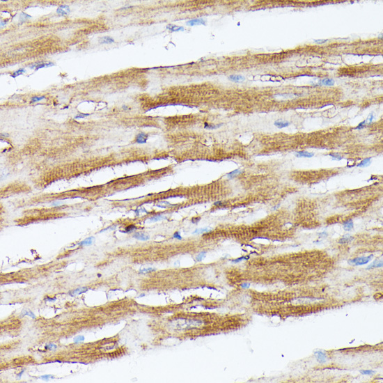 Immunohistochemistry - NUBP1 Polyclonal Antibody 